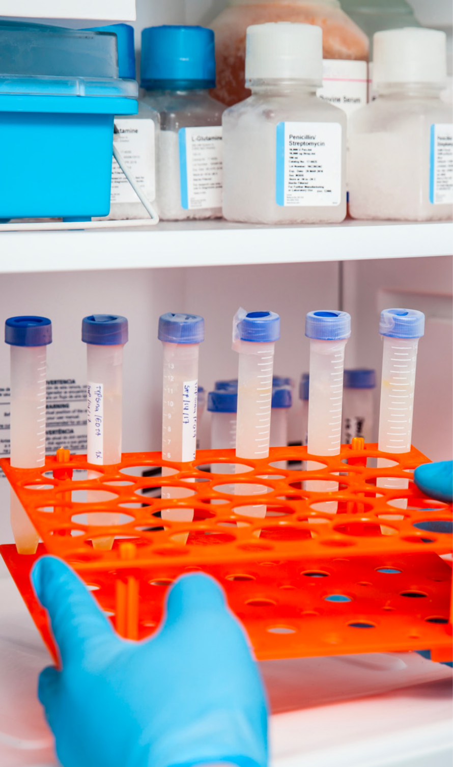 samples in orange holder